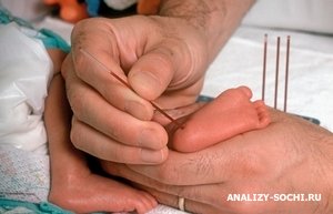 Какие анализы берут у новорожденного в первый год жизни